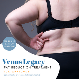 Venus Legacy Fat reduction Treatment