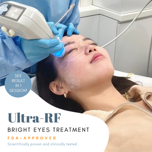 Ultra-RF Bright Eyes Treatment