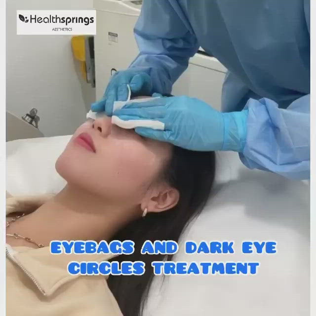 Ultra-RF Bright Eyes Treatment
